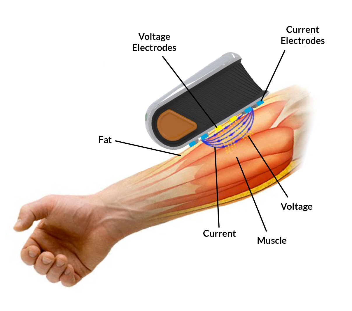 arm-2